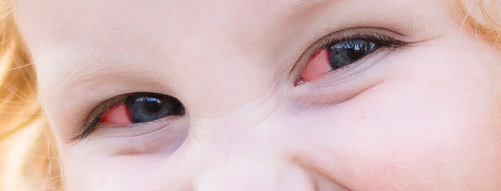 Whiten Eyes in Lightroom