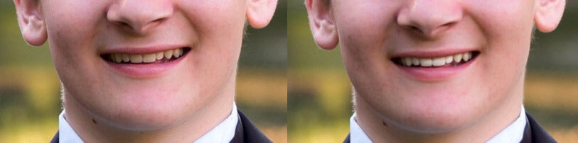 Lightroom Face Retouch